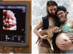 pria-hamil-melahirkan-laki-laki.jpg