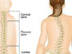 skoliosis2.jpg