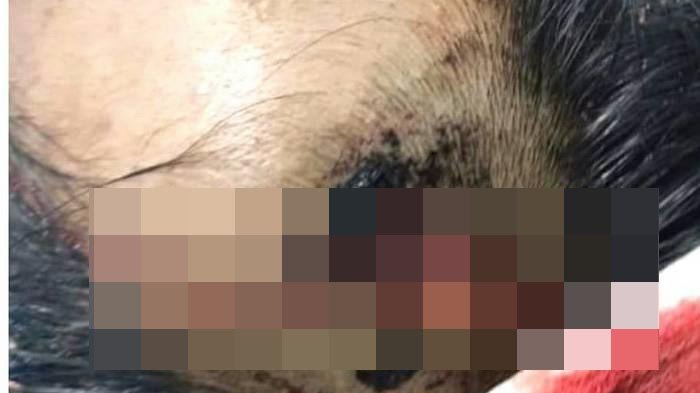 Jambret Ganas di Tangerang Tusuk Kepala Korbannya Pakai Obeng