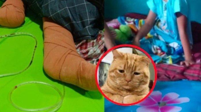 Sosok Nabila Febrianti Bocah SD Kehilangan Kaki Demi Selamatkan Kucing