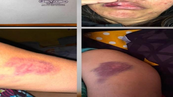 Tak Terima Digerebek Saat Selingkuh, Polisi di Sulawesi Utara Hajar Istri