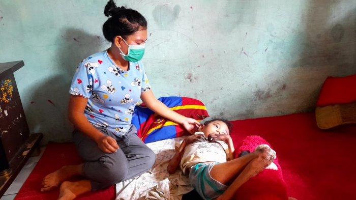 Kisah Balqis, Bocah 9 Tahun Idap Penyakt Langka, Jari harus Diamputasi atau Dibiarkan Lepas Sendiri