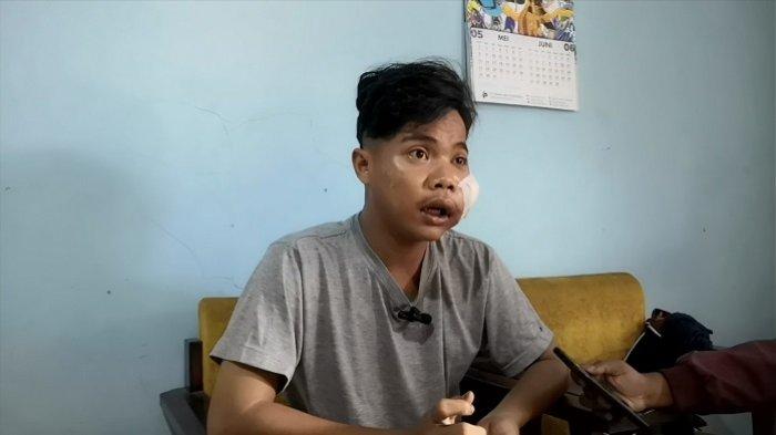 Polres Jakpus Sedang Melakukan Pengejaran Terhadap Pelaku Pembegalan Terhadap Candra di Kemayoran