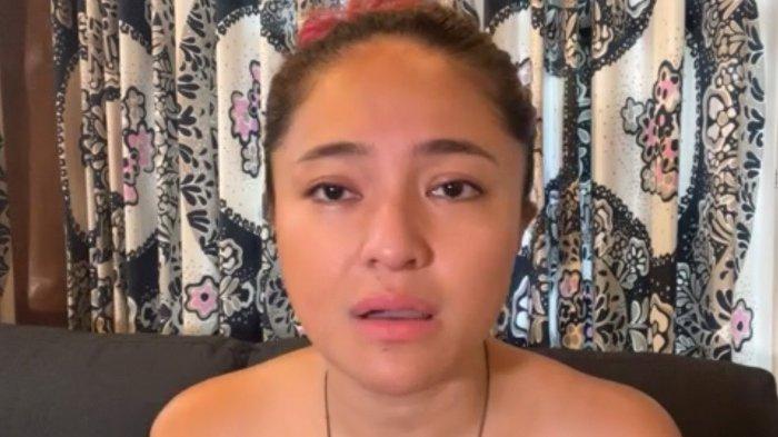 Marshanda Yakin Sembuh dari Tumor Payudara, Berpikir Positif hingga Rutin Jalani Perawatan Intensif