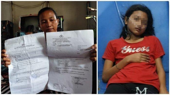 Berawal Saling Ejek, Remaja Perempuan Ini Dikeroyok Tetangganya, Dinjak-injak, Dipukuli, Digigit