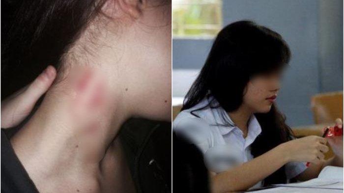 Ibunya Lihat Ada Cupangan di Leher, Gadis 16 Tahun Ini Mengaku Telah Berhubungan Intim dengan 5 Pria