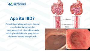 Tangkapan-layar-terkait-penyait-radang-usus.jpg