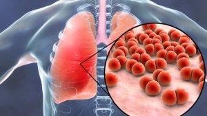 pneumonia-meningkat-pada-anak-di-jakarta.jpg
