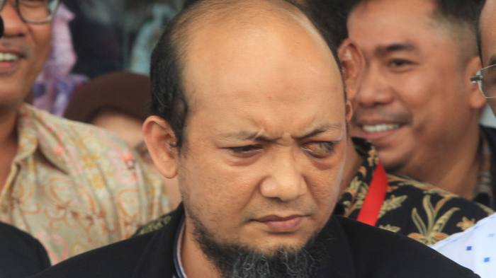 20180222berita-foto-begini-gaya-novel-saat-datangi-kpk7_20180222_203809.jpg