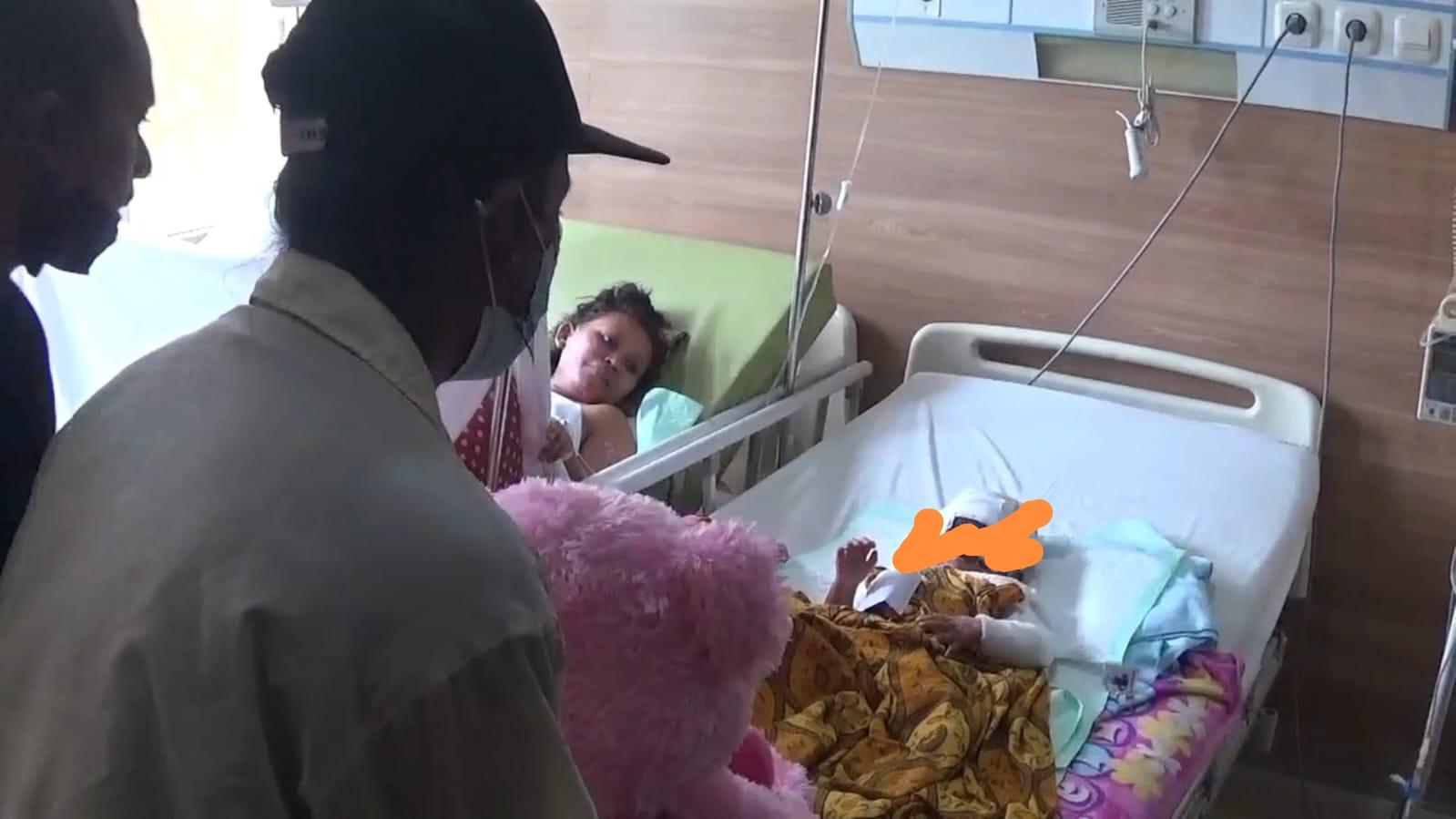 Disiram Air Keras Ayahnya, Kelopak Mata Balita di Bekasi Sulit Menutup