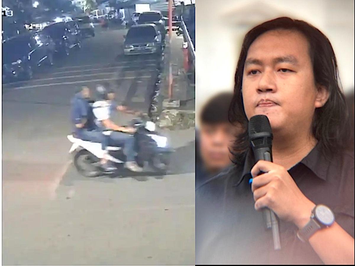 RSCM: Mata Andrie Yunus Ditutup Sementara, Penyembuhan Butuh Waktu 4-6 Bulan