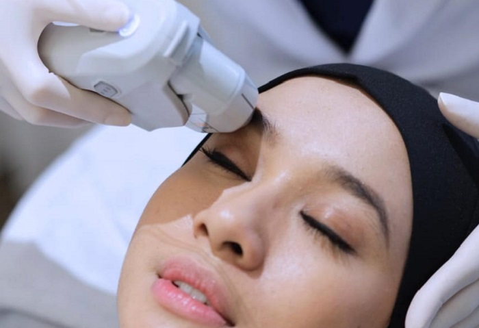 Kenali 3 Kombinasi Treatment Ultherapy, Botox, Filler dan Collagen Stimulator untuk Perawatan Wajah