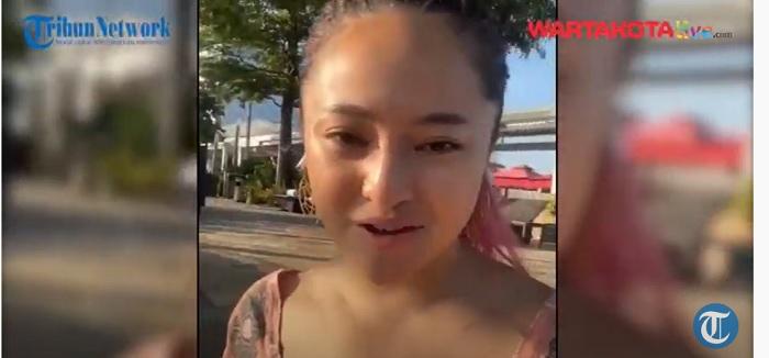 Idap Tumor Payudara, Marshanda Mohon Doa Agar Sembuh