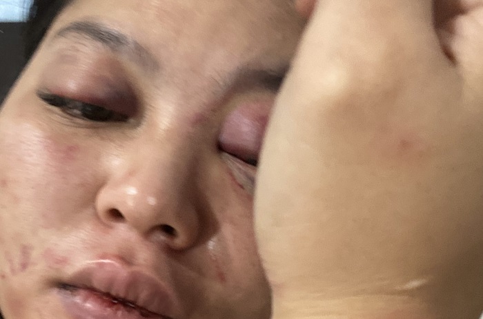 Diduga Cemburu karena Peluk Transpuan, Dika Hajar Kekasihnya hingga Gegar Otak, Begini Kisahnya