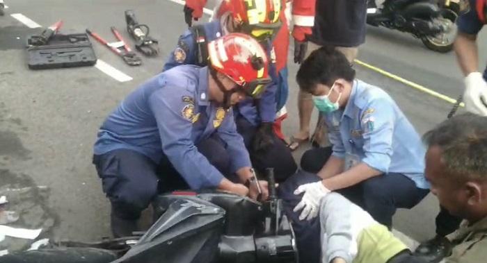 Alami Kecelakaan Tunggal, Wanita Pengendara Motor Terkena Gagang Spion pada Matanya