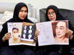 Istri-Putra-Siregar-dan-ibunda-Rico-Valentino-tunjukan-bukti-pengeroyokan.jpg