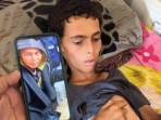 MALNUTRISI-GAZA.jpg