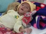 bayi-gizi-buruk2_20171026_102836.jpg