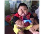 kenzi-balita-obesitas.jpg