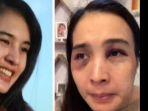 kolase-putri-balqis-sebelum-dan-setelah-dianiaya-suaminya-bani-idham-fitrianto-bayuni.jpg