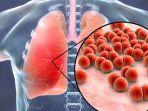 pneumonia-meningkat-pada-anak-di-jakarta.jpg