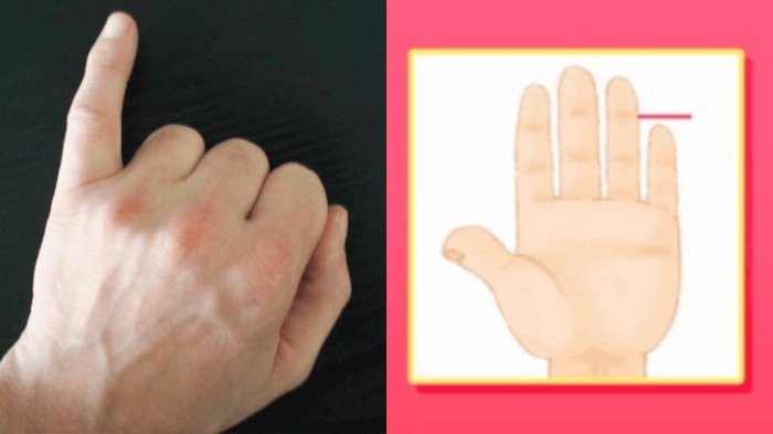 Jangan Anggap Sepele, Ternyata Jari Kelingking Bisa Bongkar Kepribadian Aslimu!