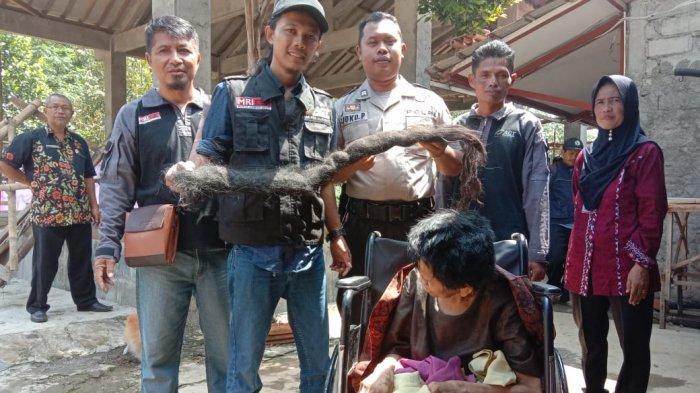 Mengaku Bulu Kuduk Merinding, Ini Kisah Relawan Potong Rambut Gimbal Sukiyah yang Jadi Sarang Hewan