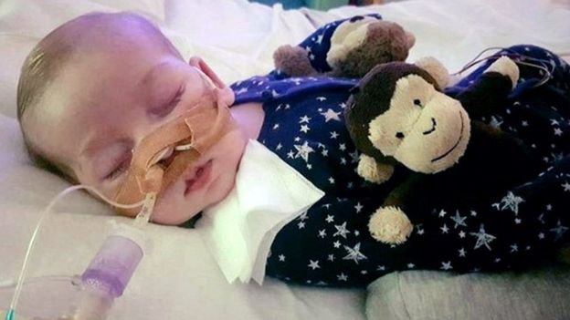 charlie-gard_20170725_175705.jpg