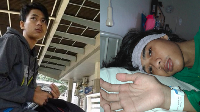 Gara-gara Idap Penyakit Mengerikan, Perut Pemuda Ini Harus Dilubangi