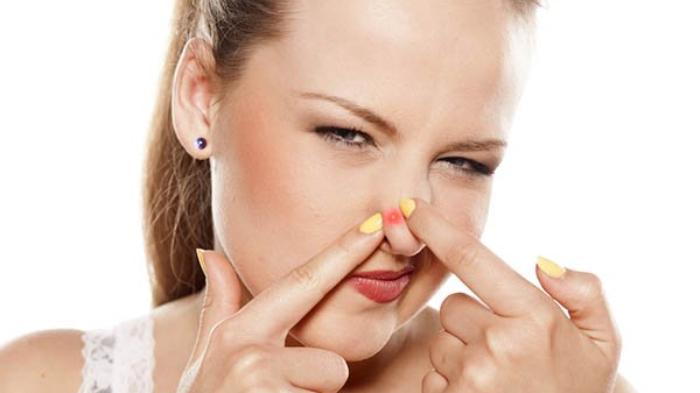 ilustrasi-jerawat-di-hidung.jpg