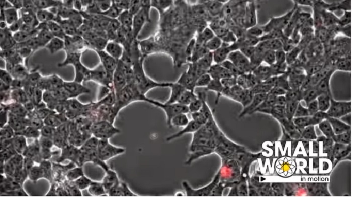 Bisa Bikin Mudah Lupa dan Sulit Fokus saat Isoman, Ini 6 Penyebab Kabut Otak Selain Infeksi Covid-19