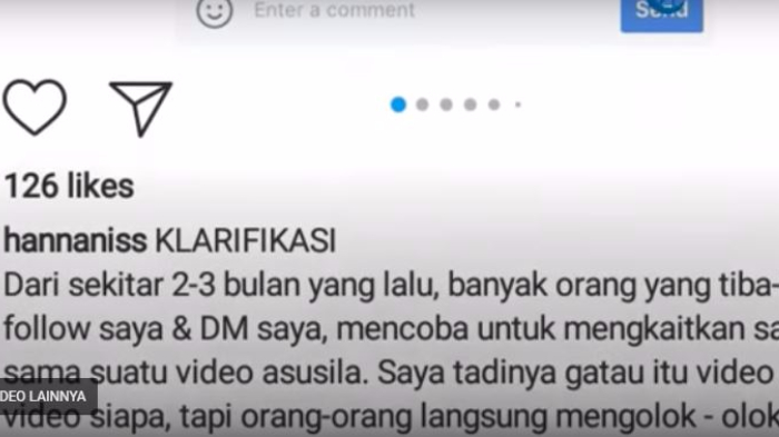 Pengakuan Hanna Anissa Soal Kondisi Dada, Buktikan Dirinya Bukan 'Pemain' Video Panas?